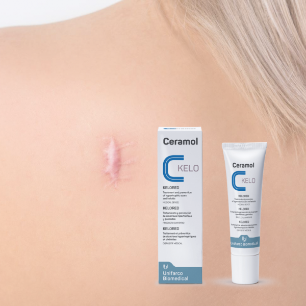 CERAMOL KELORED 30 ML