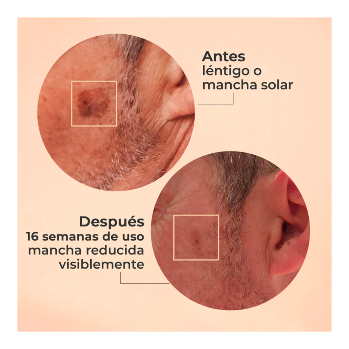 SEGLE Sérum Glicolmix 30ml