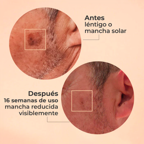 SEGLE Sérum Glicolmix 30ml