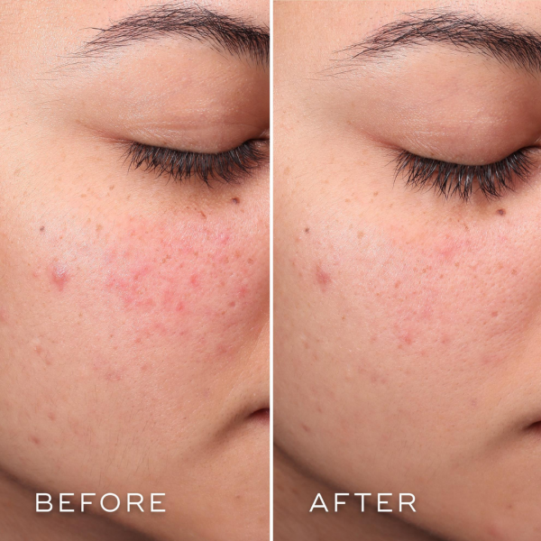 MEDIK8 PRESS & CLEAR 150 ML 2