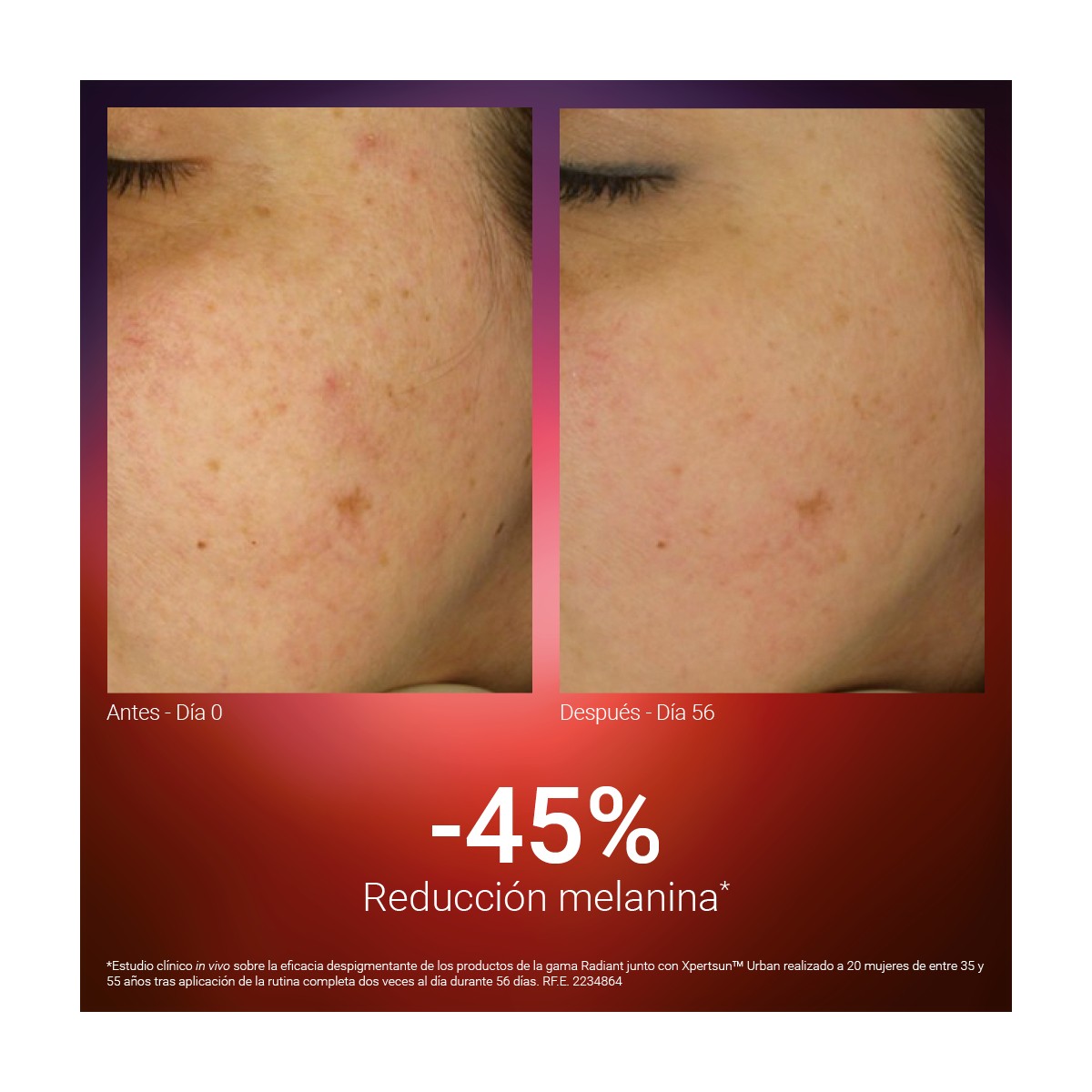 SINGULADERM Radiant Forte Intensive Cream