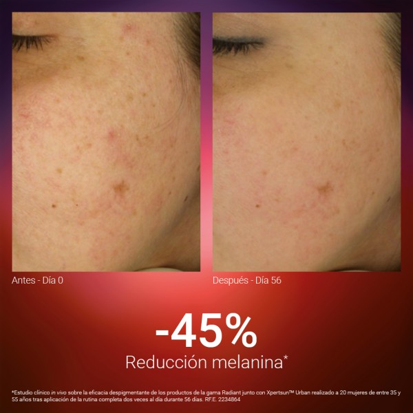 SINGULADERM Radiant Forte Intensive Cream