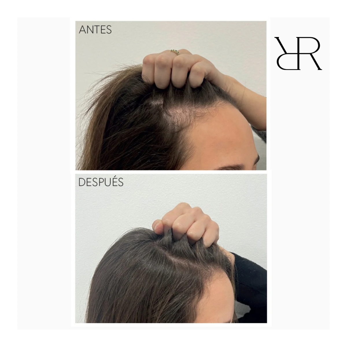 Moncho Moreno Rapunhair 70 ml