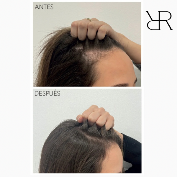 Moncho Moreno Rapunhair 70 ml