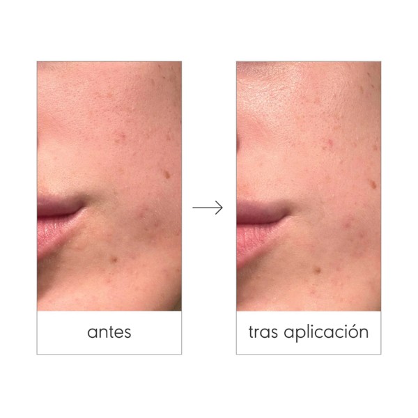 Nieves Enzymatic Peeling Application Set